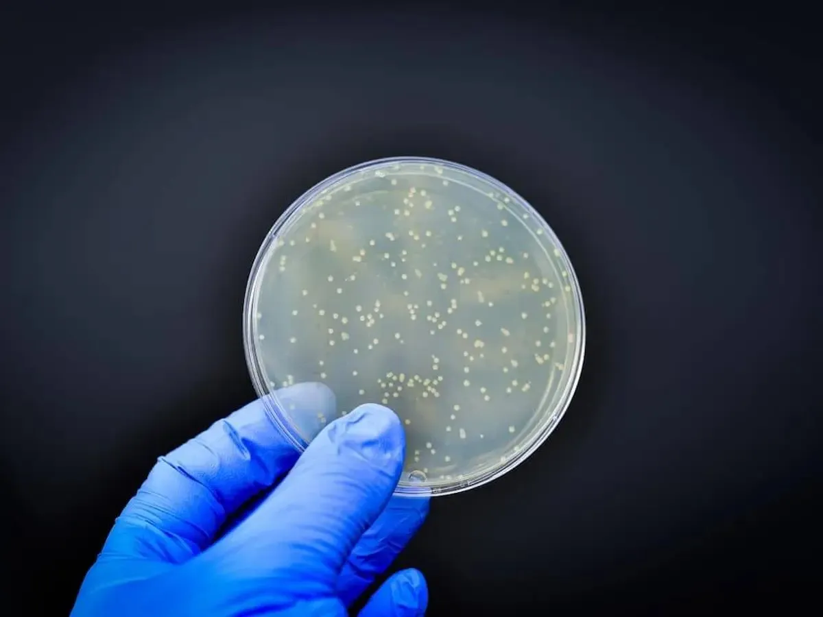 La inteligencia artificial acelera el descubrimiento de nuevos antibioticos para combatir la resistencia bacteriana 2